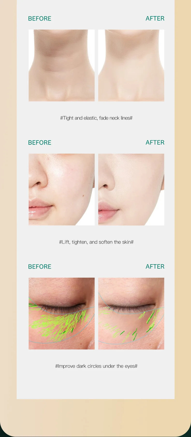 HF Facial Machine All-round Face Massager Neck Facial Eye Lifting Massage Microcurrent Skin Rejuvenation Anti Wrinkle Skin Care